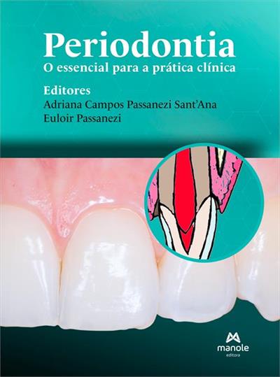 PERIODONTIA: O ESSENCIAL PARA A PRATICA CLINICA