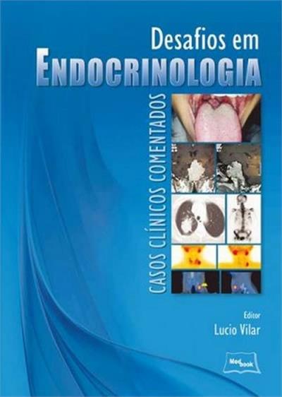 DESAFIOS EM ENDOCRINOLOGIA: CASOS CLINICOS COMENTADOS