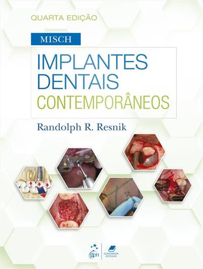 MISCH - IMPLANTES DENTAIS CONTEMPORANEOS